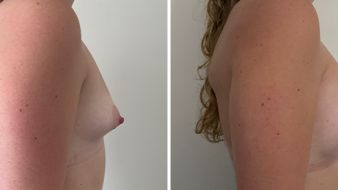 Breast Abnormality client3